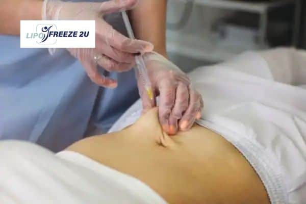 How Does Aqualyx Fat Dissolving Injection Work to Break Down Fat Bridport?