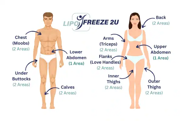 Areas you can have fat freezing treatment Bridport