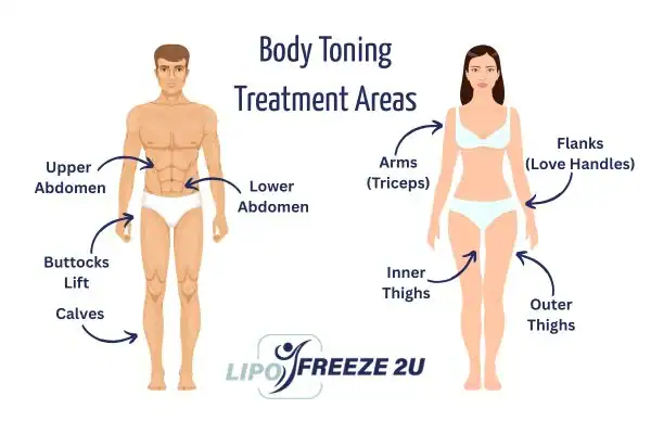 Graphic showing where you can have Body toning Treatment Bridport on your body