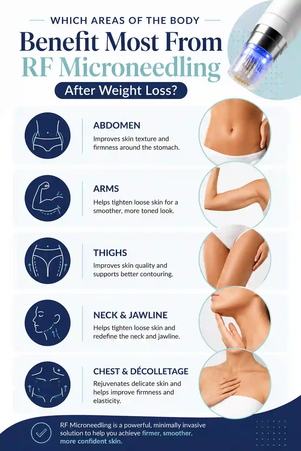 Which Areas of the Body Benefit Most From RF Microneedling After Weight Loss Bridport